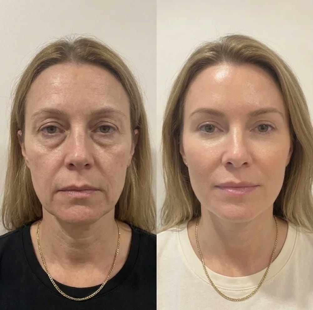 Kundebilde av Lovelle Glow